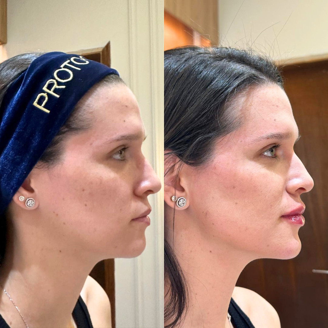 Antes e depois (site) 2