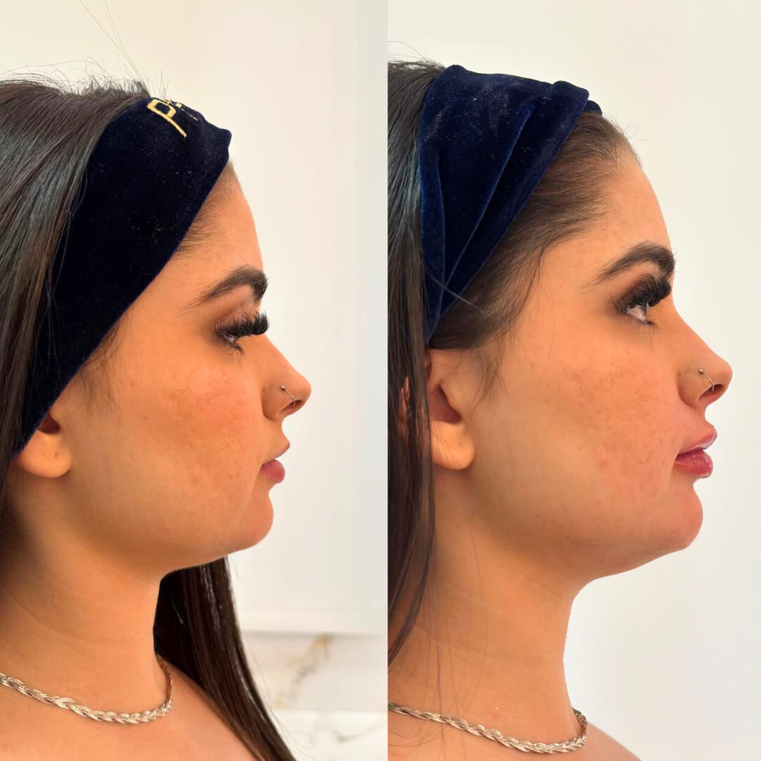 Antes e depois (site)