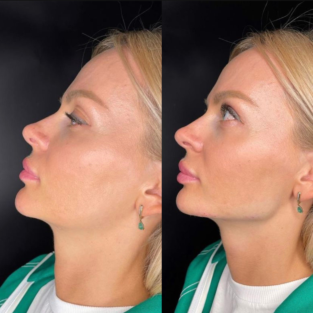 Antes e depois site
